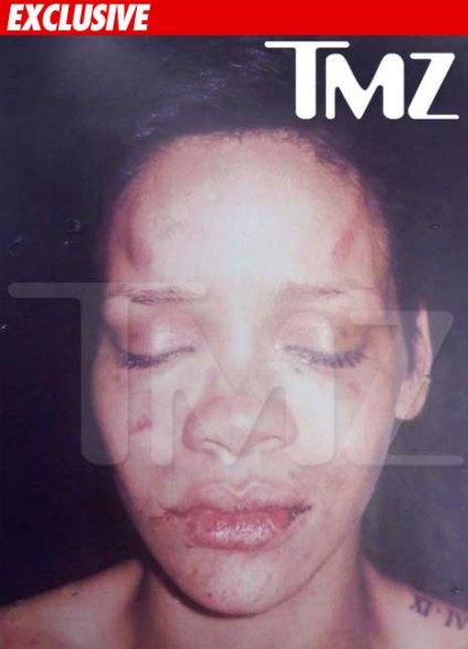 rihanna pictures leaked chris brown. incident with Chris Brown